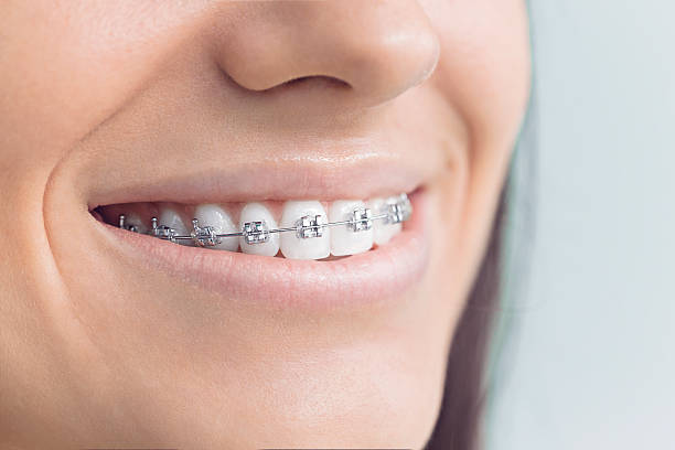 Why Choose Us for Your Dental Needs in Mountain Grove, MO